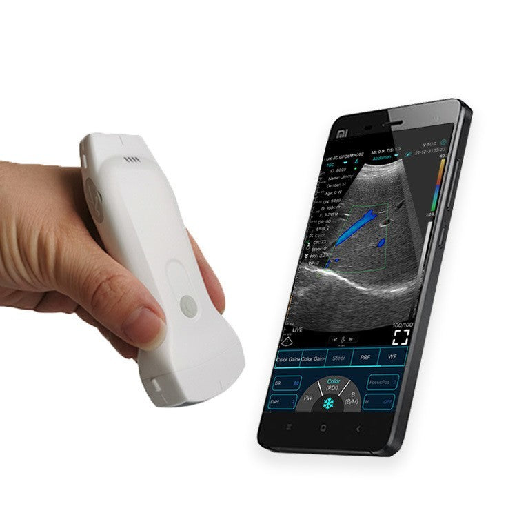 128E Wireless Color Doppler 3-in-1 Ultrasound Scanner with Dual Probes