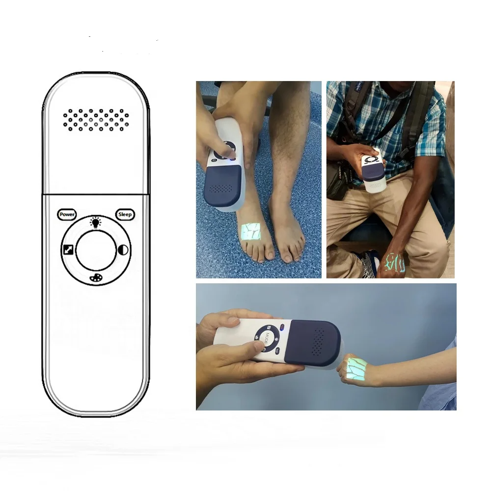 Infrared Vein Finder Vein Locator-Vein Viewer for Nurses, Hospital & Clinic Use