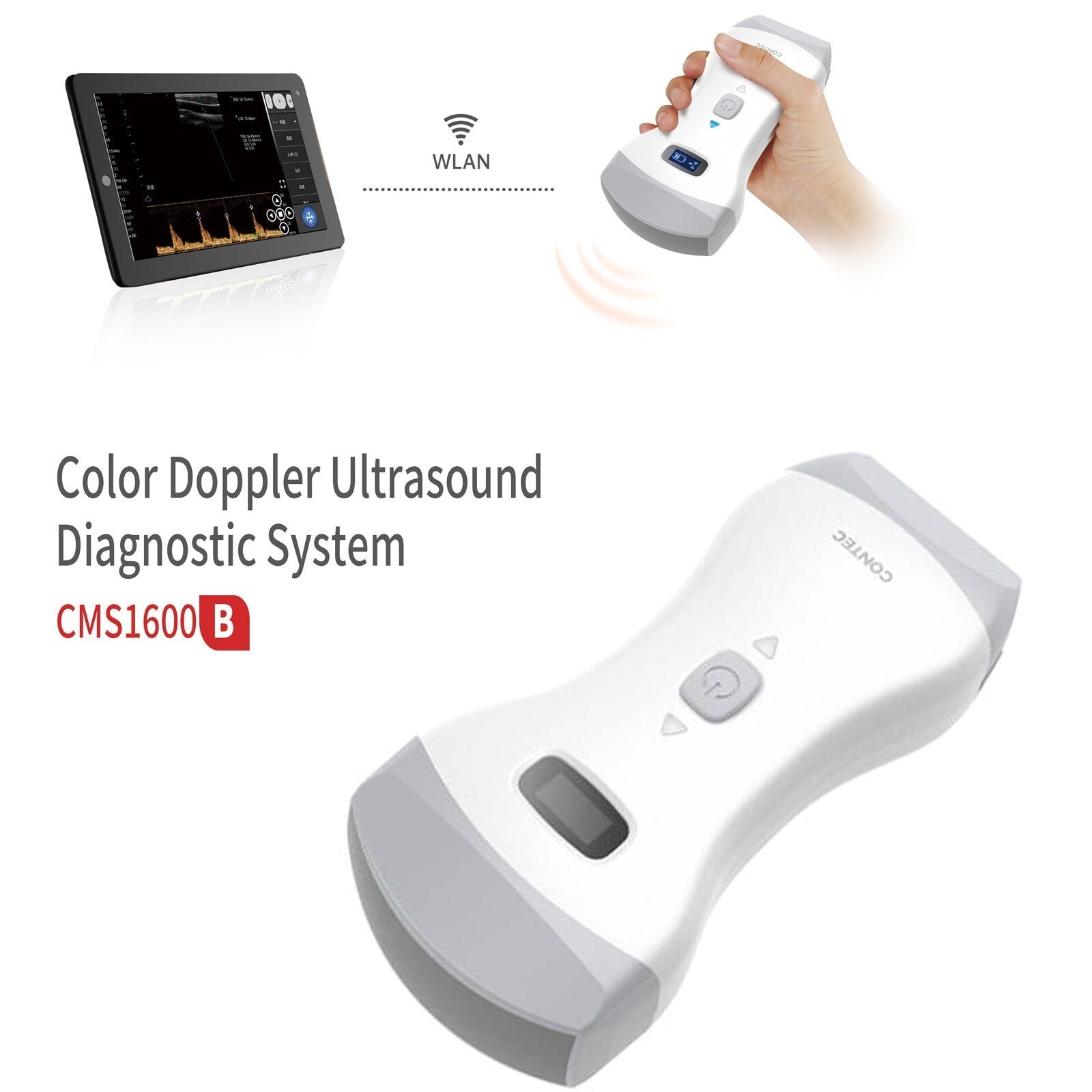 32CH Portable WiFi Ultrasound Scanner with 128e Color Doppler for Clinical Use