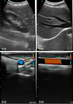 128 Elements Linear Ultrasound Probe with wifi Wireless & USB IOS Adroid Windows
