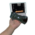 Portable 192E Wireless Ultrasound - 3-in-1 Probe w/Color Doppler