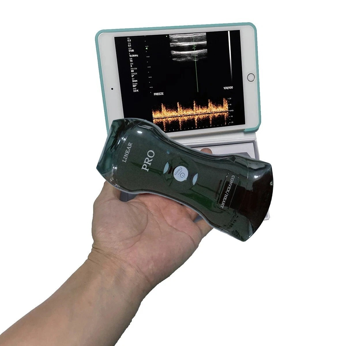 Portable 192E Wireless Ultrasound - 3-in-1 Probe w/Color Doppler