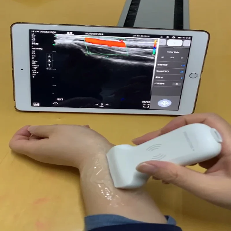 128 Elements Linear Ultrasound Probe with wifi Wireless & USB IOS Adroid Windows