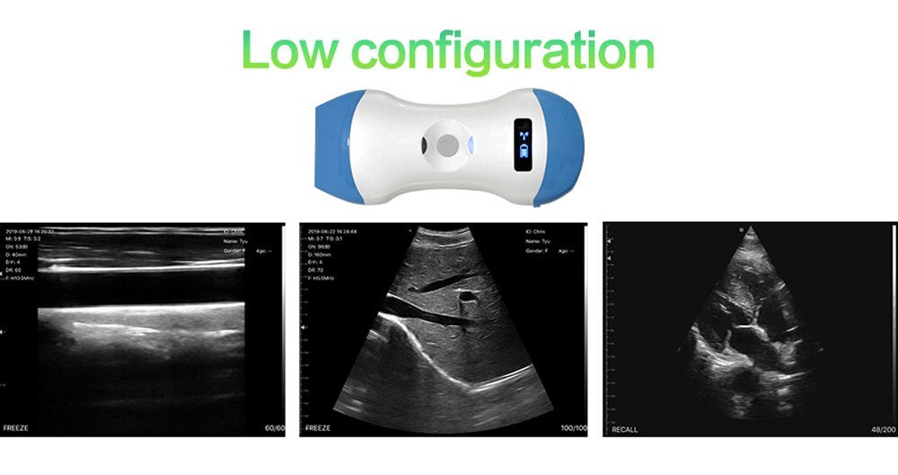 128E Wireless 3-in-1 Ultrasound Probe – Portable, Dual Head, Color Doppler Scann