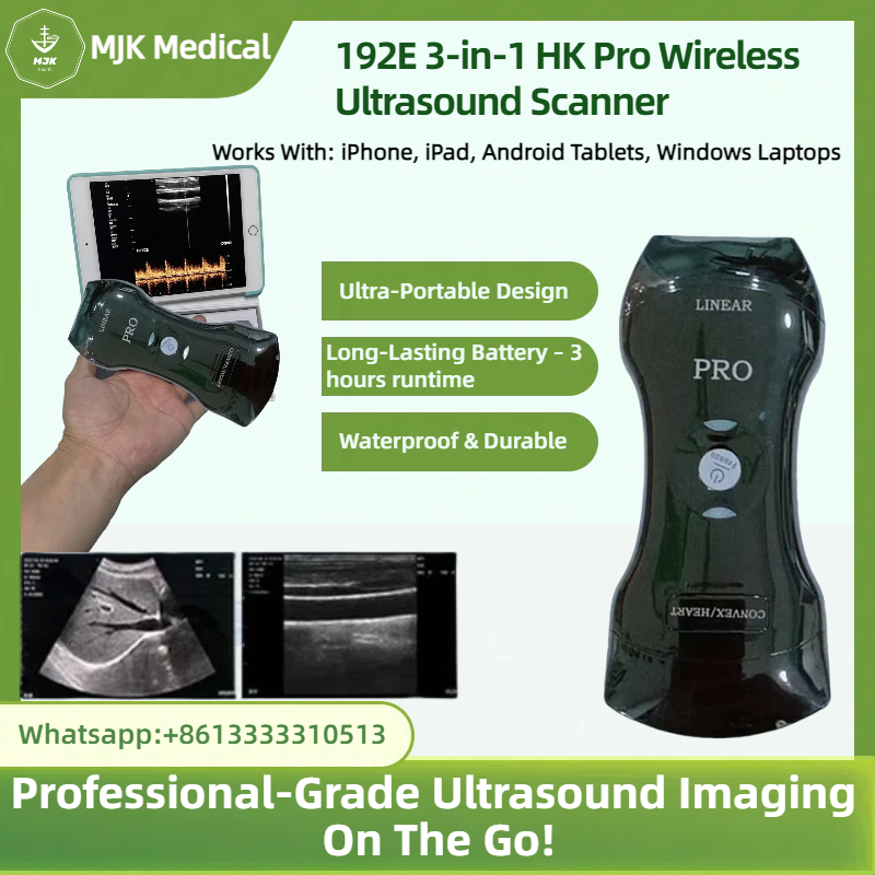 Portable 192E Wireless Ultrasound - 3-in-1 Probe w/Color Doppler