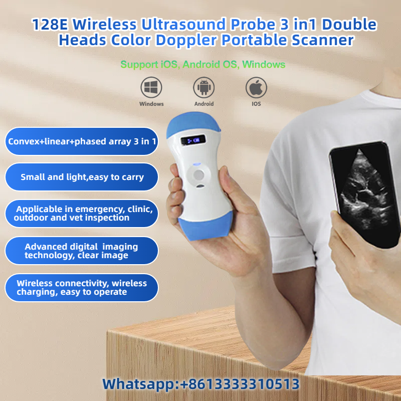 128E Wireless 3-in-1 Ultrasound Probe – Portable, Dual Head, Color Doppler Scann