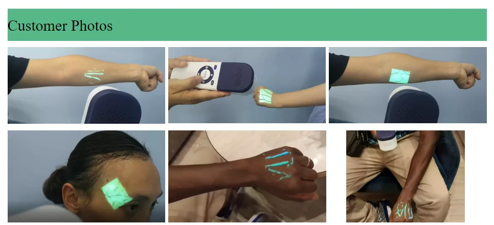 Infrared Vein Finder Vein Locator-Vein Viewer for Nurses, Hospital & Clinic Use