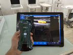 Portable 192E Wireless Ultrasound - 3-in-1 Probe w/Color Doppler