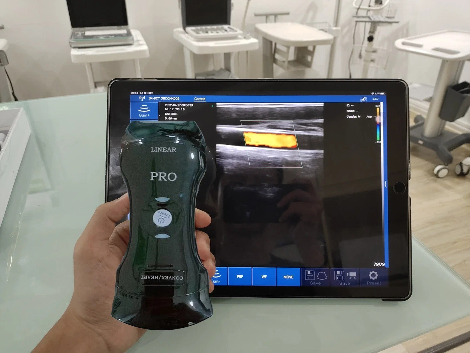 Portable 192E Wireless Ultrasound - 3-in-1 Probe w/Color Doppler