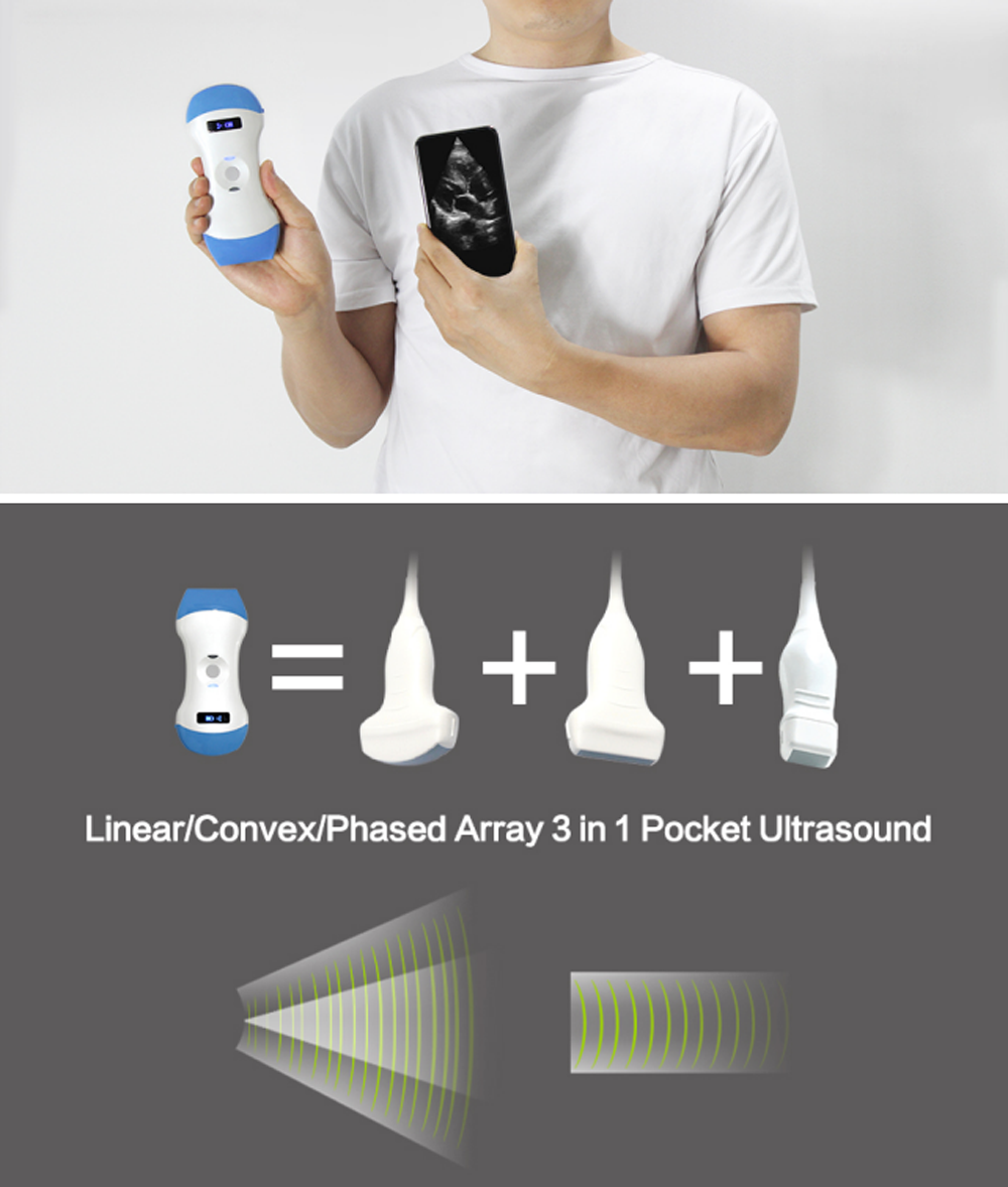 128E Wireless 3-in-1 Ultrasound Probe – Portable, Dual Head, Color Doppler Scann