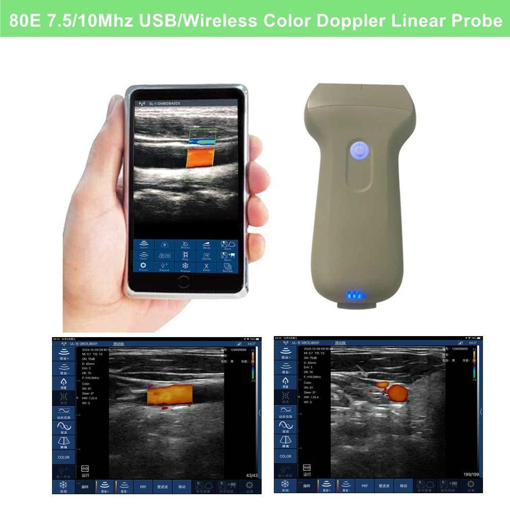 Portable 96E Ultrasound Machine Wireless w/ Color Doppler & Linear Probe