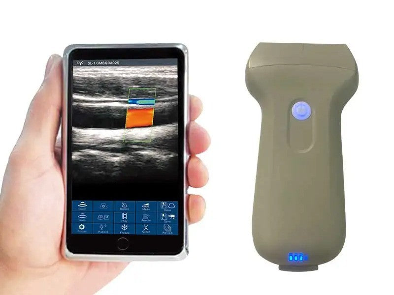 Portable 96E Ultrasound Machine Wireless w/ Color Doppler & Linear Probe