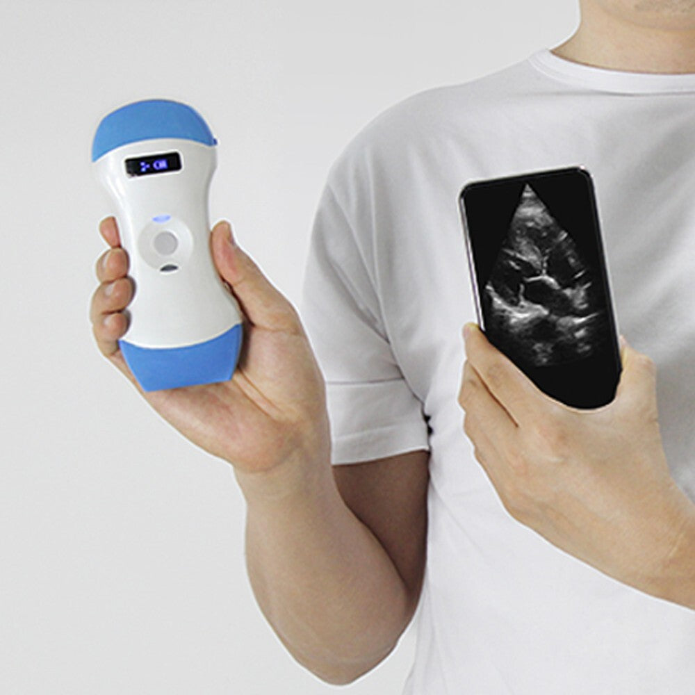 128E Wireless 3-in-1 Ultrasound Probe – Portable, Dual Head, Color Doppler Scann