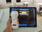192 Elements IOS Android Wifi Windows Wireless Ultrasound Probe