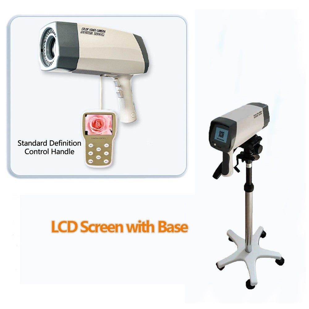 Digital electronic colposcope, remote control with screen, standard definition