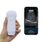 128E Wireless Color Doppler 3-in-1 Ultrasound Scanner with Dual Probes