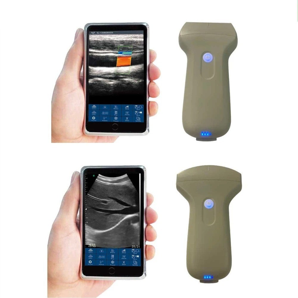 Portable 96E Ultrasound Machine Wireless w/ Color Doppler & Linear Probe