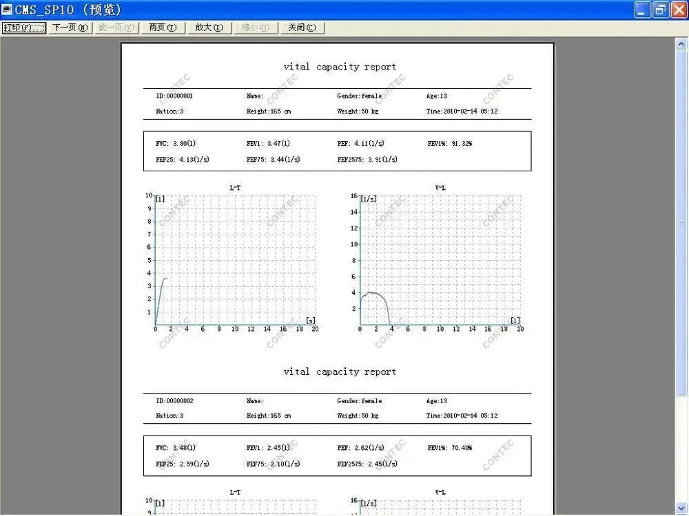 SP10 Handheld Spirometer -Vitalograph Lung Diagnostic Device