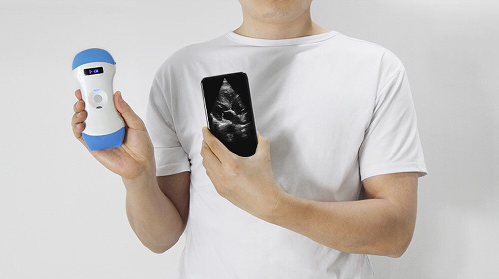 128E Wireless 3-in-1 Ultrasound Probe – Portable, Dual Head, Color Doppler Scann