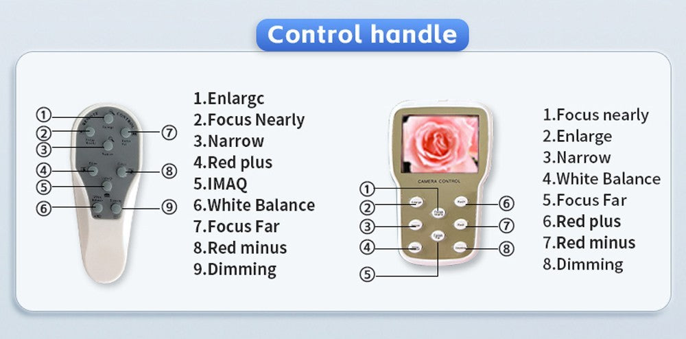 Digital electronic colposcope, remote control with screen, standard definition